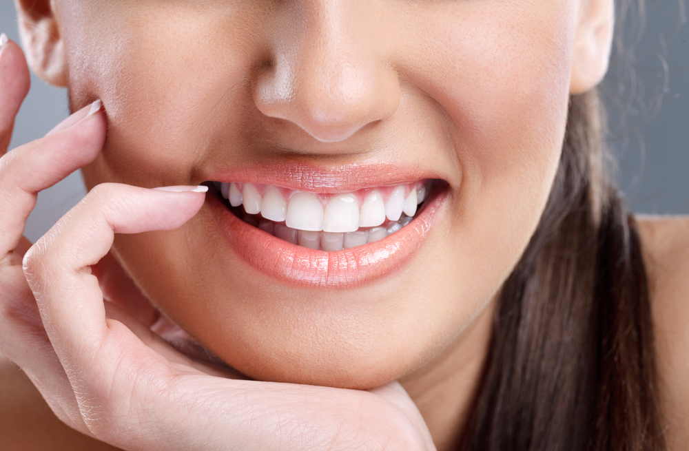 Teeth Whitening in Del Mar